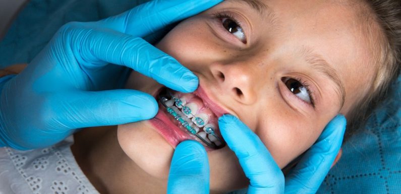 Look for Signs to Decide Whether Your Child Needs Braces