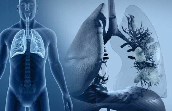 Respiratory Failure and Mechanical Ventilation: A Clinical Overview