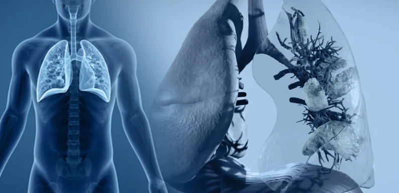 Respiratory Failure and Mechanical Ventilation: A Clinical Overview